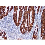 Validation Data - Anti-Beta-catenin Antibody [YN00106m] (A288823)