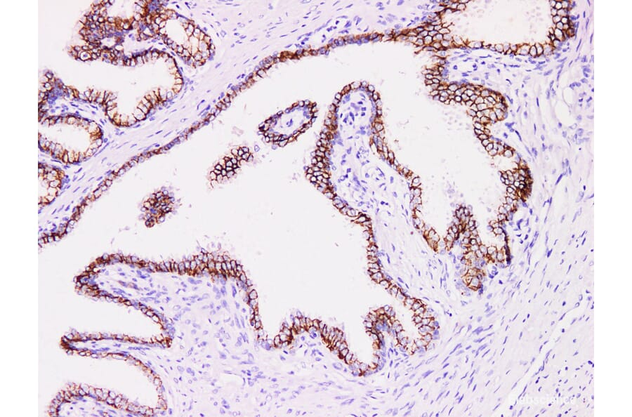 Validation Data - Anti-Prostatic Acid Phosphatase(PSAP) Antibody [YN01415m] (A288825)