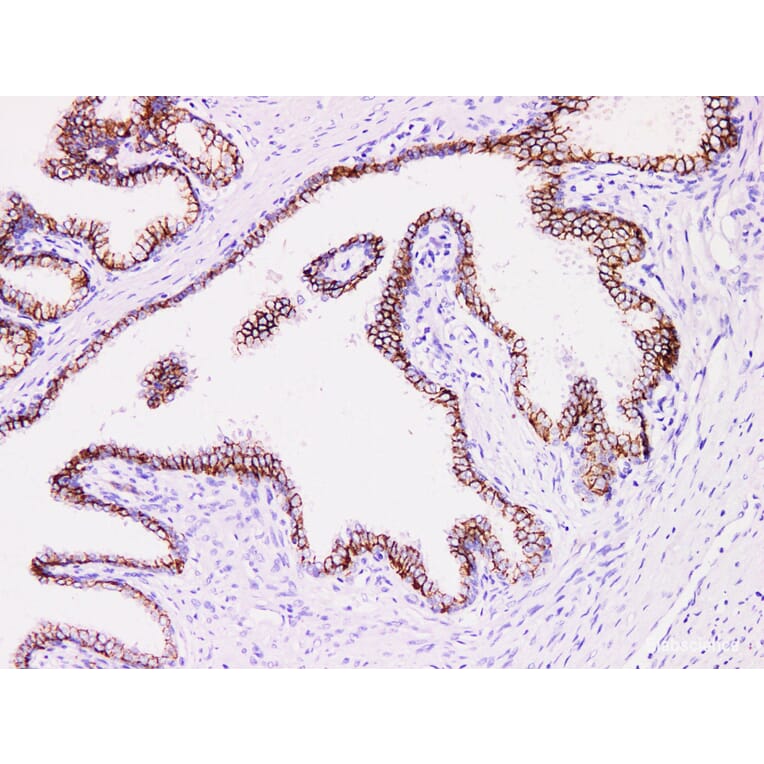 Validation Data - Anti-Prostatic Acid Phosphatase(PSAP) Antibody [YN01415m] (A288825)