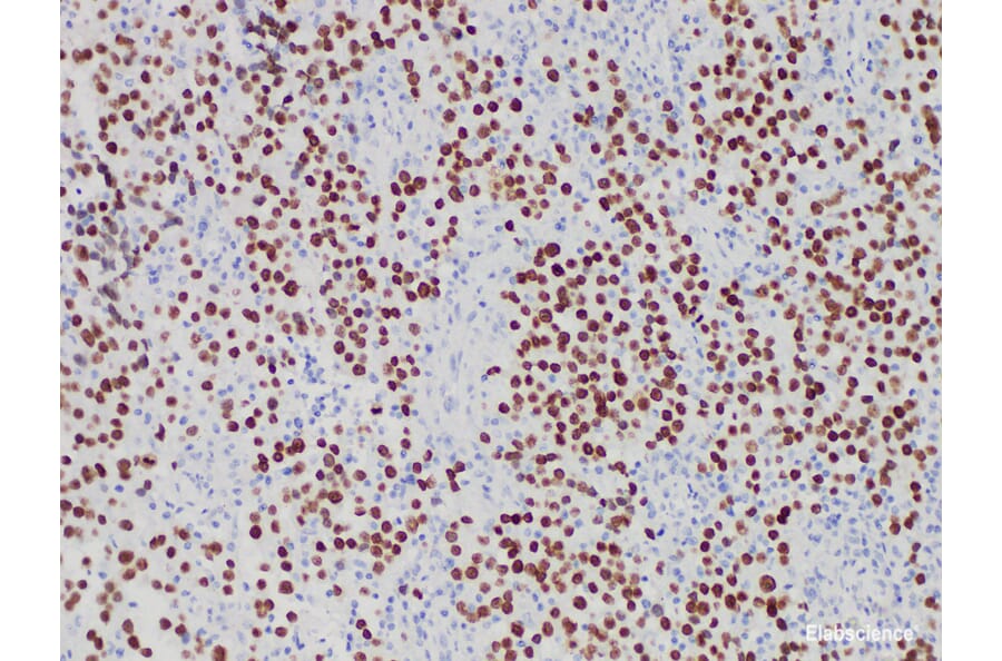 Validation Data - Anti-SALL4 Antibody [YN01506m] (A288826)