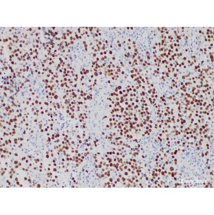 Validation Data - Anti-SALL4 Antibody [YN01506m] (A288826)