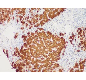 Validation Data - Anti-Arginase-1 Antibody [YN00096m] (A288827)