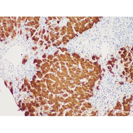 Validation Data - Anti-Arginase-1 Antibody [YN00096m] (A288827)