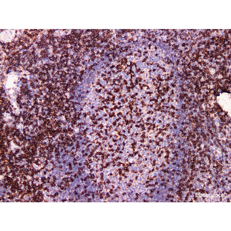 Validation Data - Anti-CD2 Antibody [YN00196m] (A288829)