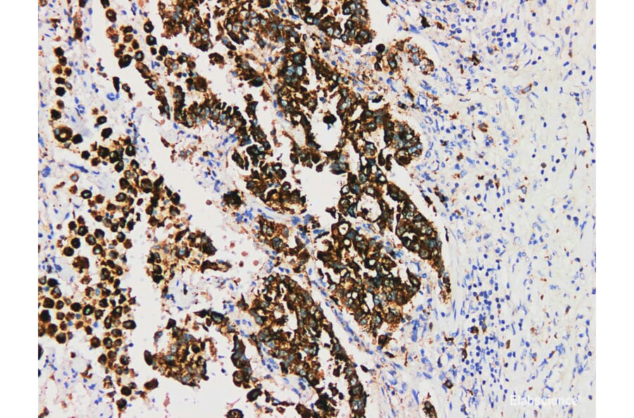 Validation Data - Anti-Napsin A Antibody [YN01176m] (A288830)