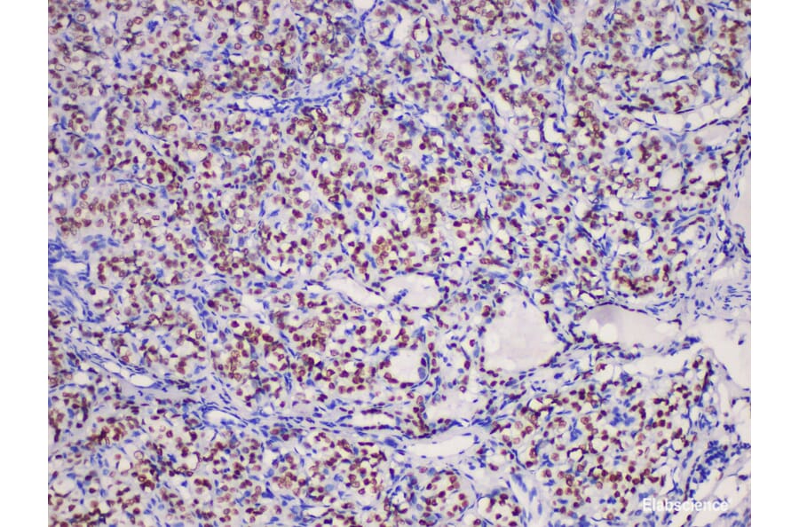 Validation Data - Anti-Thyroid transcription factor-1(TTF1) Antibody [YN01606m] (A288831)