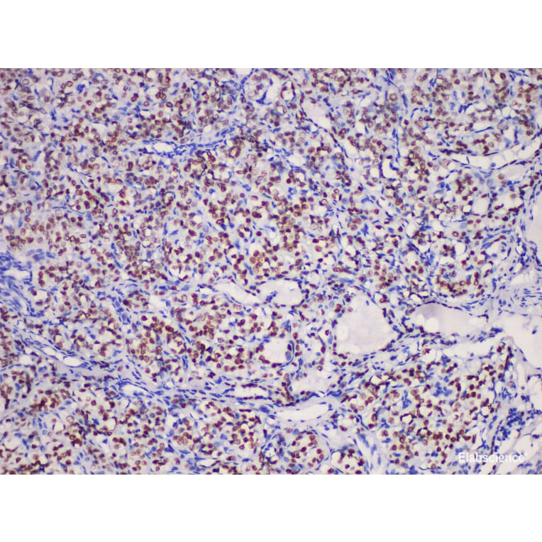 Validation Data - Anti-Thyroid transcription factor-1(TTF1) Antibody [YN01606m] (A288831)