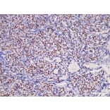 Validation Data - Anti-Thyroid transcription factor-1(TTF1) Antibody [YN01606m] (A288831)