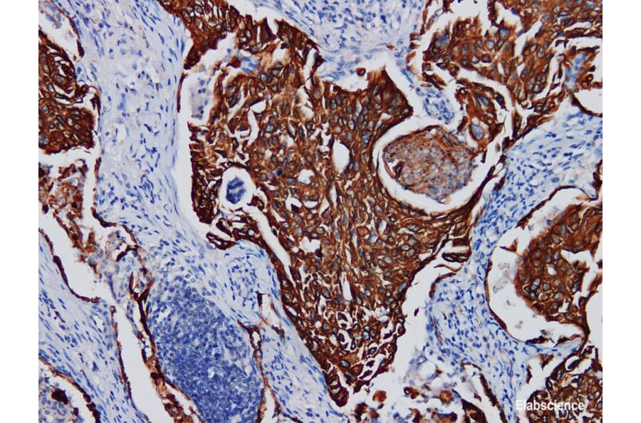 Validation Data - Anti-Cytokeratin Pan Antibody [YN00746m] (A288832)