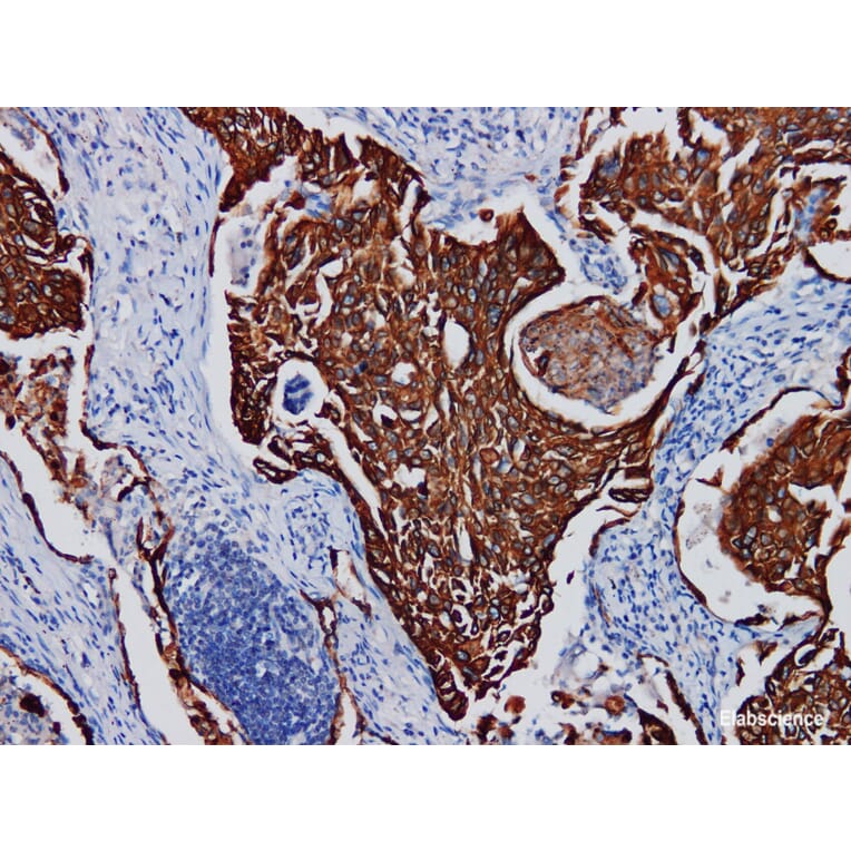 Validation Data - Anti-Cytokeratin Pan Antibody [YN00746m] (A288832)