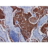 Validation Data - Anti-Cytokeratin Pan Antibody [YN00746m] (A288832)