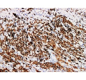 Validation Data - Anti-Melan-A Antibody [YN01056m] (A288833)