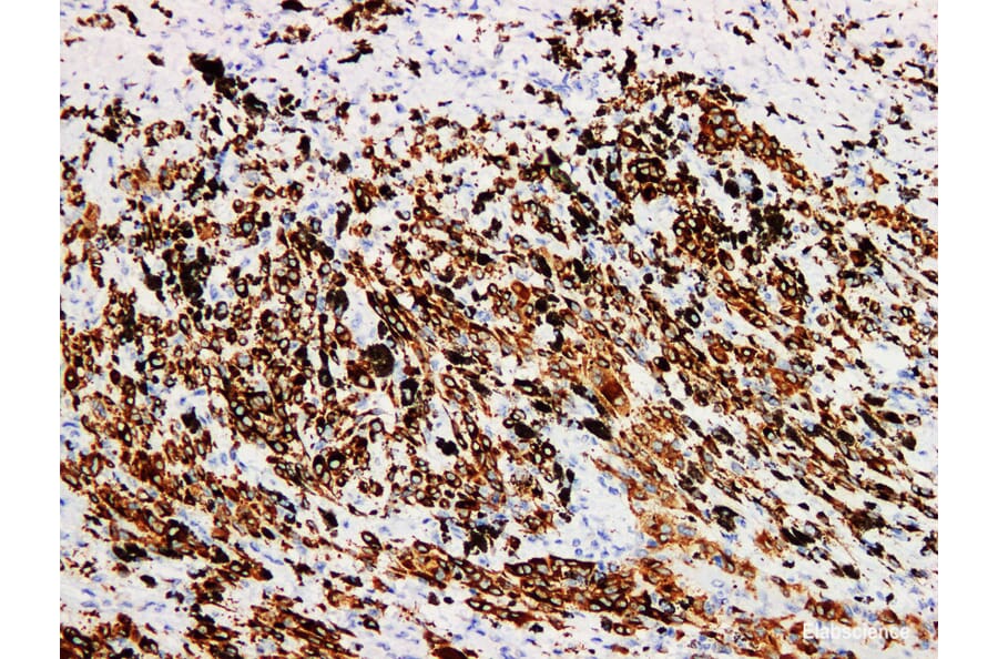 Validation Data - Anti-Melan-A Antibody [YN01056m] (A288833)