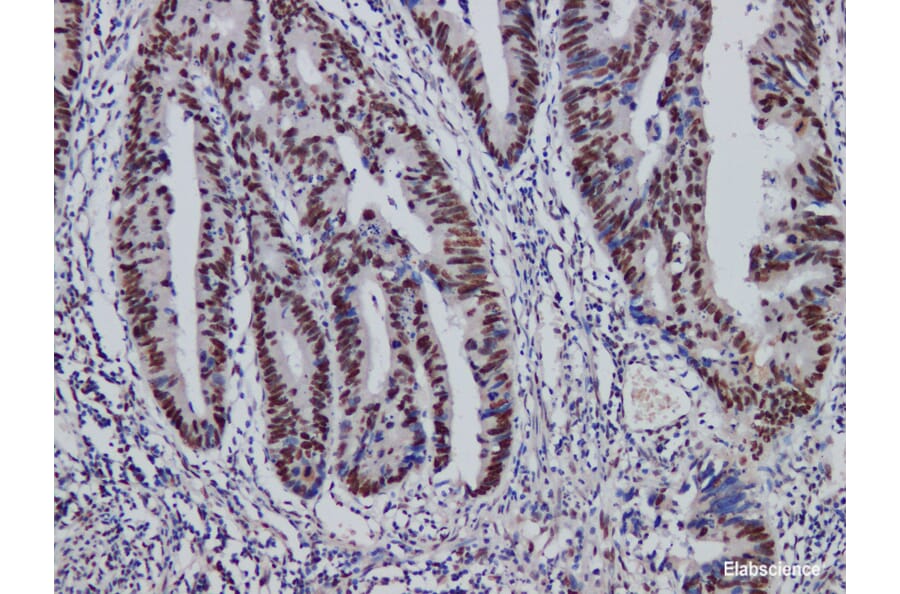 Validation Data - Anti-MutS Protein Homolog 2(MSH2) Antibody [YN01126m] (A288834)