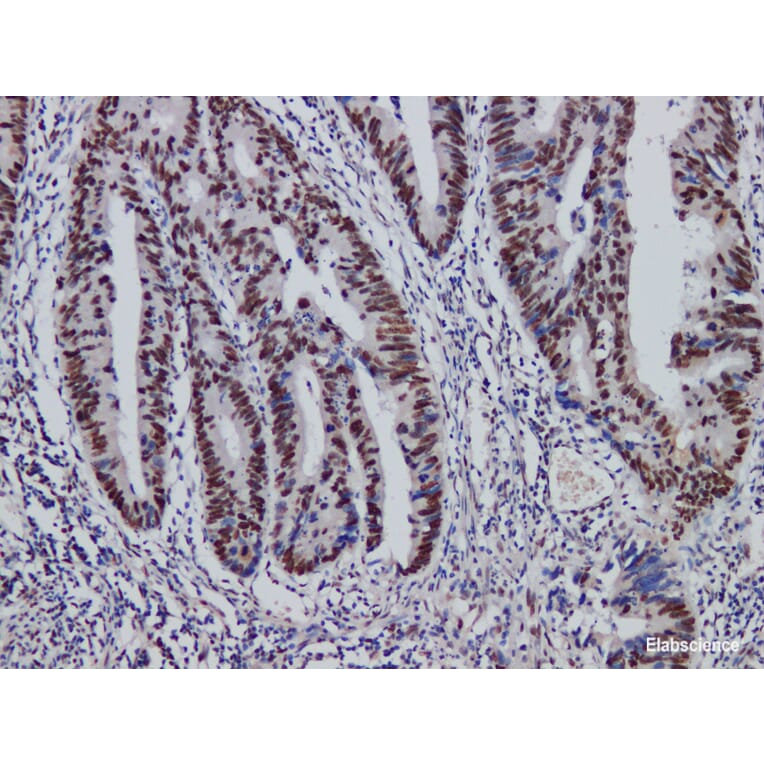 Validation Data - Anti-MutS Protein Homolog 2(MSH2) Antibody [YN01126m] (A288834)