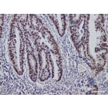 Validation Data - Anti-MutS Protein Homolog 2(MSH2) Antibody [YN01126m] (A288834)