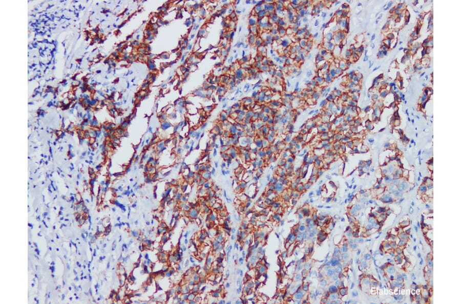 Validation Data - Anti-p120 Antibody [YN01265m] (A288835)