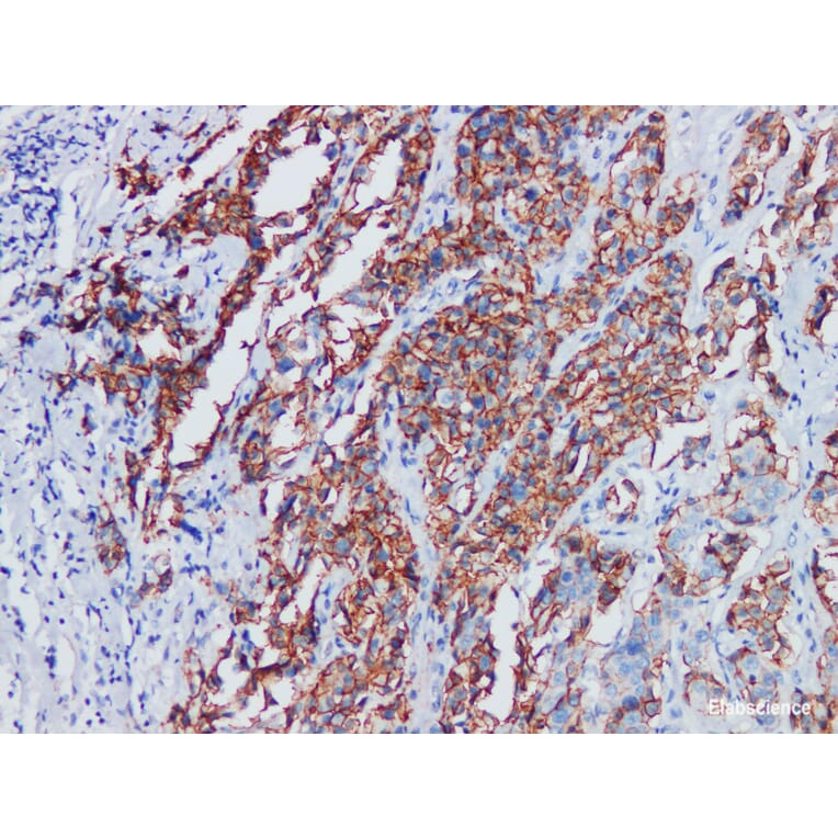 Validation Data - Anti-p120 Antibody [YN01265m] (A288835)