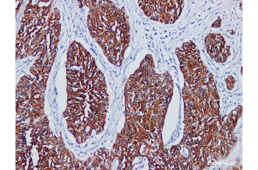 Validation Data - Anti-Cytokeratin(HMW) Antibody [YN01835r] (A288836)