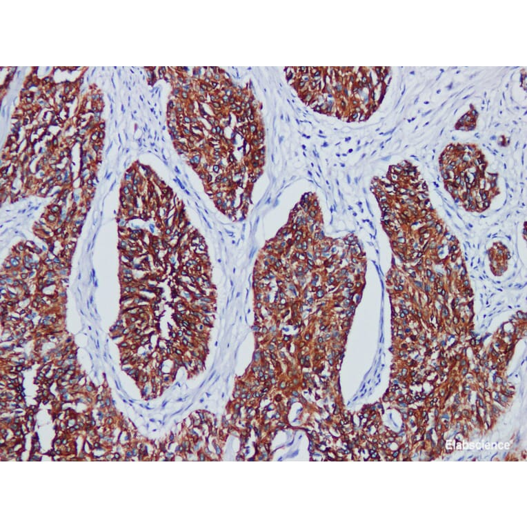 Validation Data - Anti-Cytokeratin(HMW) Antibody [YN01835r] (A288836)