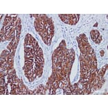 Validation Data - Anti-Cytokeratin(HMW) Antibody [YN01835r] (A288836)
