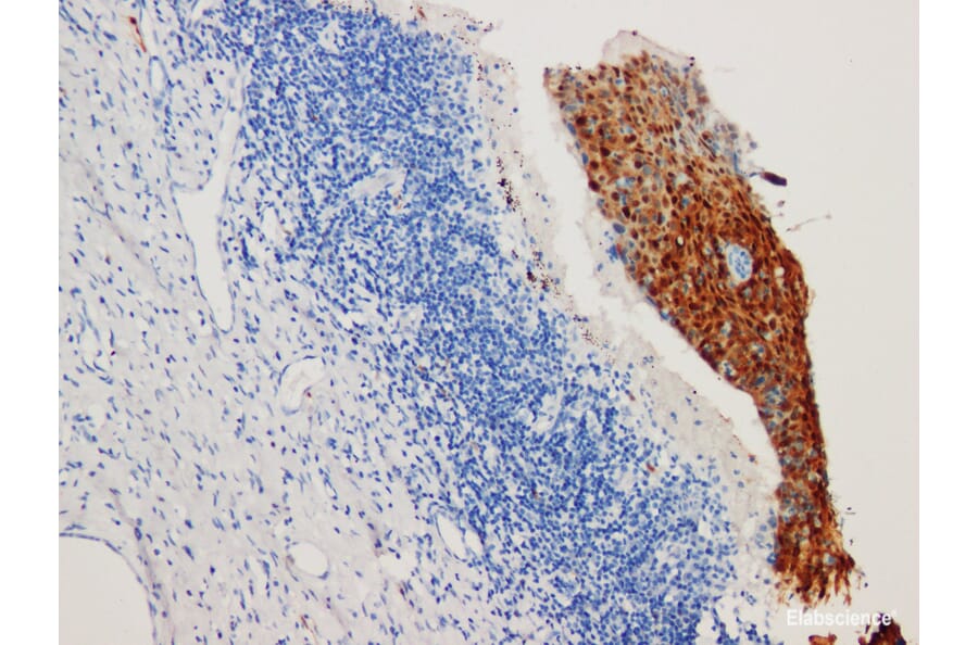 Validation Data - Anti-P16 Antibody [YN01876m] (A288837)