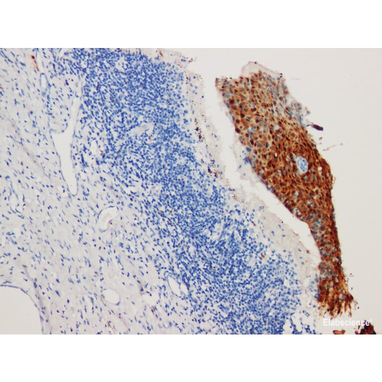 Validation Data - Anti-P16 Antibody [YN01876m] (A288837)