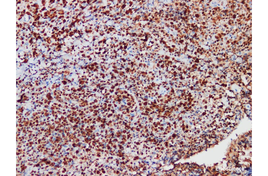 Validation Data - Anti-ALK Antibody [YN01885r] (A288838)