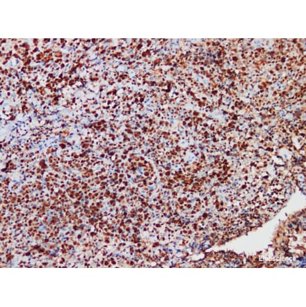 Validation Data - Anti-ALK Antibody [YN01885r] (A288838)