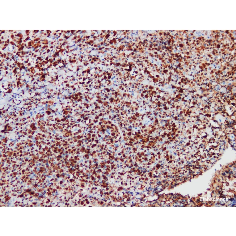 Validation Data - Anti-ALK Antibody [YN01885r] (A288838)