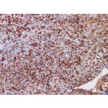 Validation Data - Anti-ALK Antibody [YN01885r] (A288838)