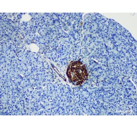 Validation Data - Anti-NSE Antibody [YN01926m] (A288839)