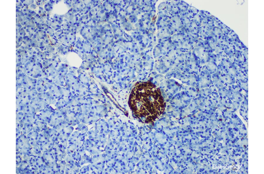 Validation Data - Anti-NSE Antibody [YN01926m] (A288839)
