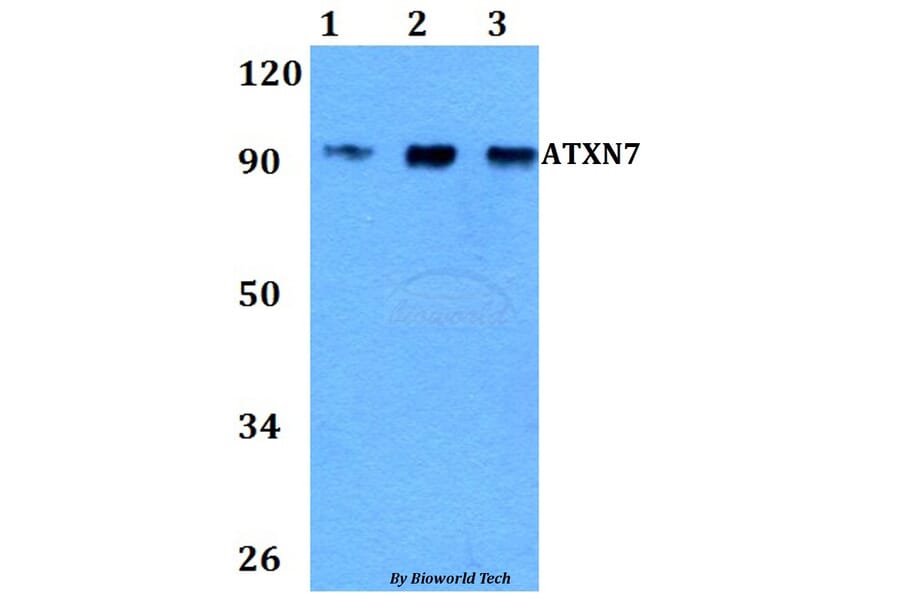 Anti-ATXN7 Antibody from Bioworld Technology (BS60839) - Antibodies.com