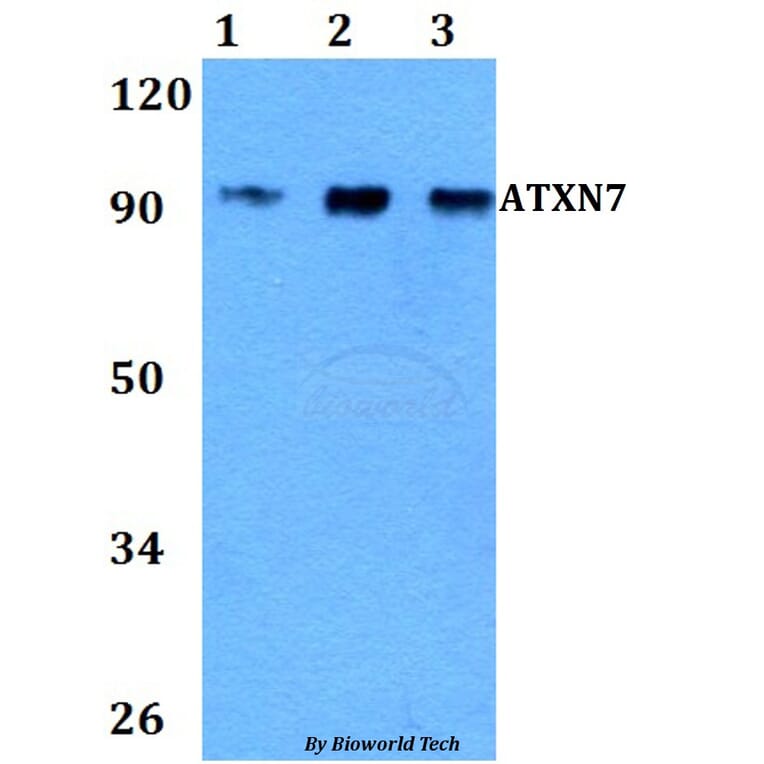 Anti-ATXN7 Antibody from Bioworld Technology (BS60839) - Antibodies.com
