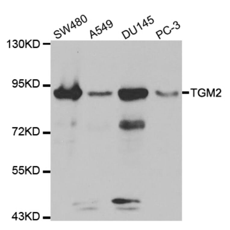 Anti-TGase2/TGM2 Antibody from Bioworld Technology (BS6084) - Antibodies.com