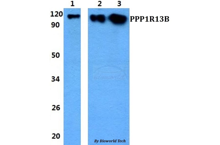 Anti-PPP1R13B Antibody from Bioworld Technology (BS60843) - Antibodies.com