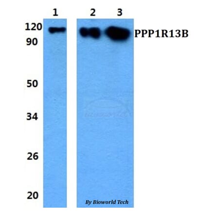 Anti-PPP1R13B Antibody from Bioworld Technology (BS60843) - Antibodies.com