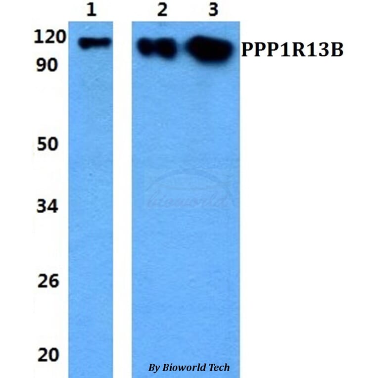 Anti-PPP1R13B Antibody from Bioworld Technology (BS60843) - Antibodies.com