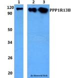 Anti-PPP1R13B Antibody from Bioworld Technology (BS60843) - Antibodies.com
