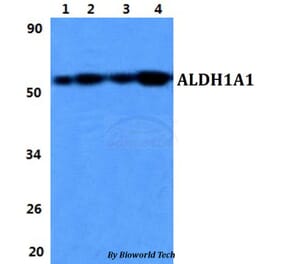 Anti-ALDH1A1 Antibody from Bioworld Technology (BS60846) - Antibodies.com