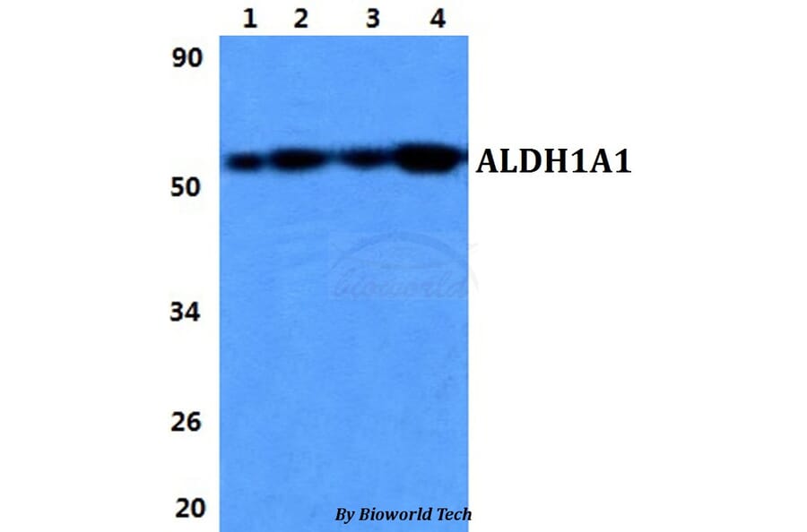 Anti-ALDH1A1 Antibody from Bioworld Technology (BS60846) - Antibodies.com