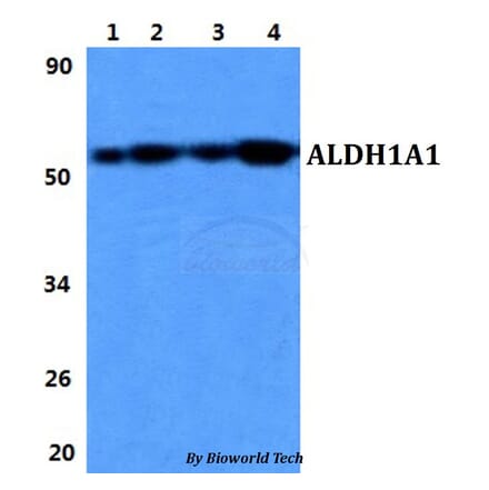 Anti-ALDH1A1 Antibody from Bioworld Technology (BS60846) - Antibodies.com