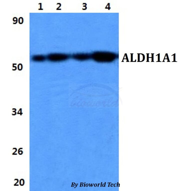 Anti-ALDH1A1 Antibody from Bioworld Technology (BS60846) - Antibodies.com