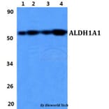 Anti-ALDH1A1 Antibody from Bioworld Technology (BS60846) - Antibodies.com