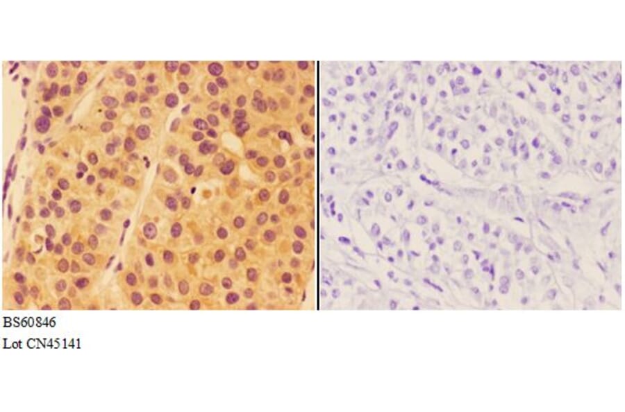 Anti-ALDH1A1 Antibody from Bioworld Technology (BS60846) - Antibodies.com