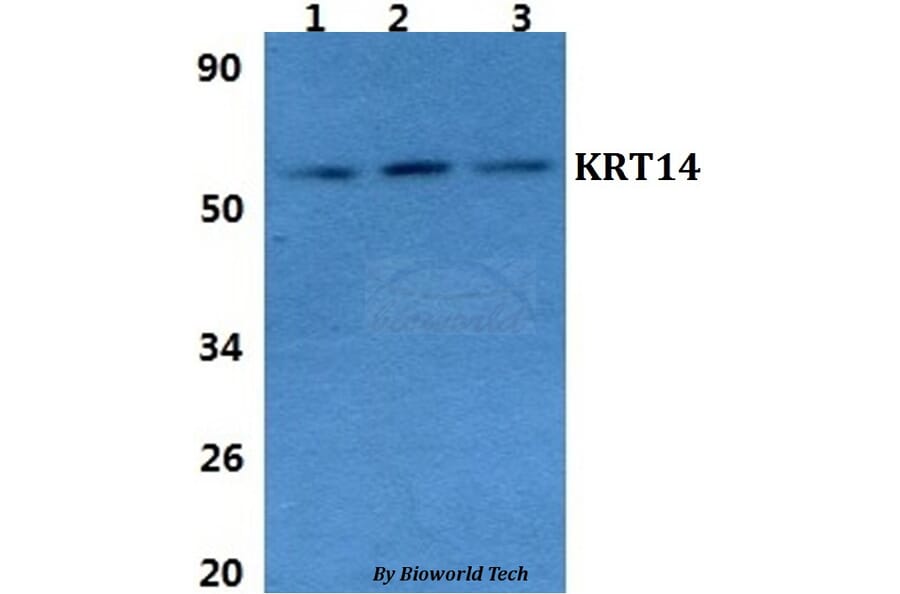Anti-Cytokeratin 14 Antibody from Bioworld Technology (BS60854) - Antibodies.com