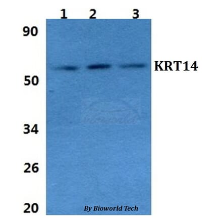 Anti-Cytokeratin 14 Antibody from Bioworld Technology (BS60854) - Antibodies.com