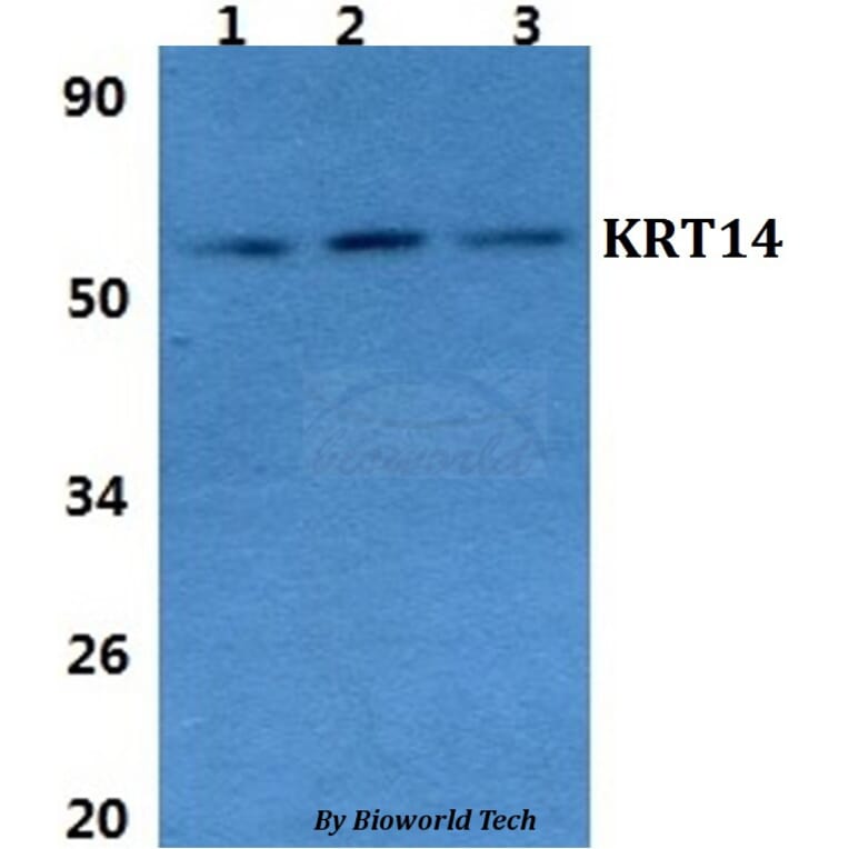 Anti-Cytokeratin 14 Antibody from Bioworld Technology (BS60854) - Antibodies.com