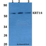 Anti-Cytokeratin 14 Antibody from Bioworld Technology (BS60854) - Antibodies.com